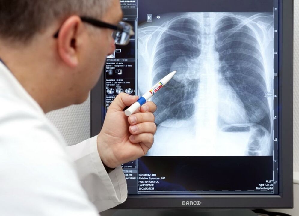diagnostika arteriální hypertenze